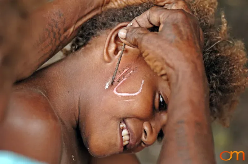 Scarification Ritual in Malaita