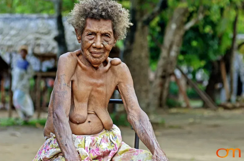 Elderly Woman from Mota Lava with Traditional Ni-Vanuatu Tattoos